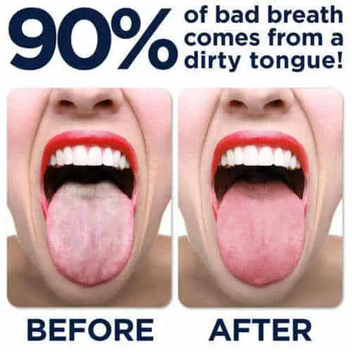 can bad breath be cured