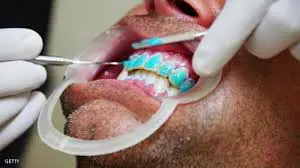 teeth whitening solutions