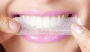 teeth whitening solutions