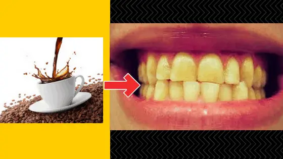 teeth whitening for coffee drinkers