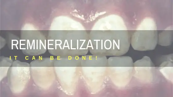 Remineralize teeth naturally