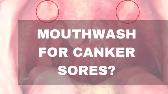 does mouthwash help canker sores