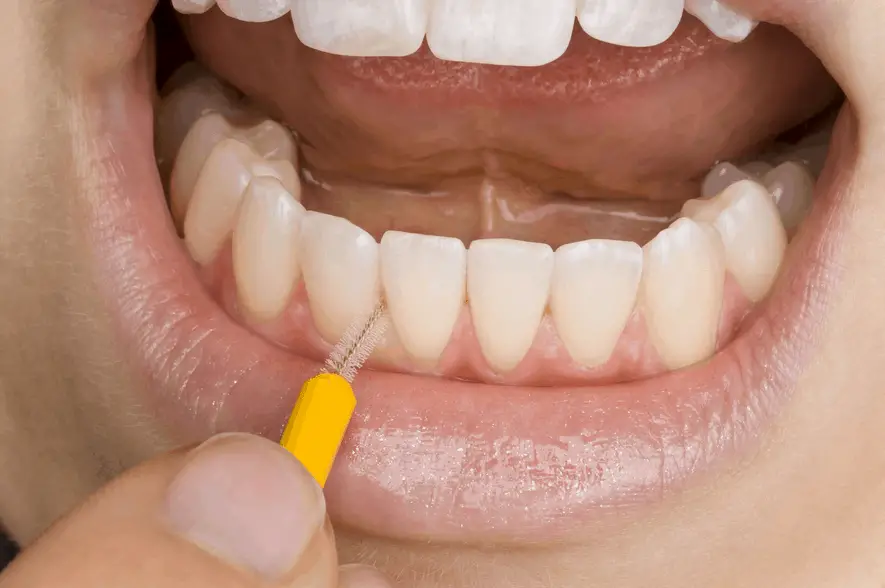 what can i do about gum disease