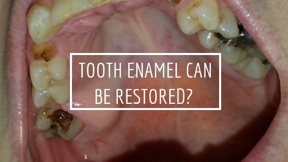 restoring tooth enamel naturally