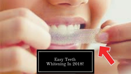 best teeth whitening strips 2018