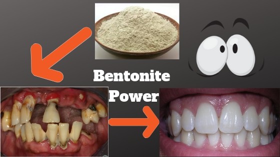 Bentonite for teeth and gums