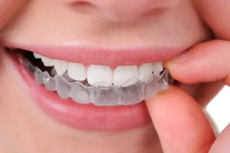 Invisalign teeth straightening options for adults