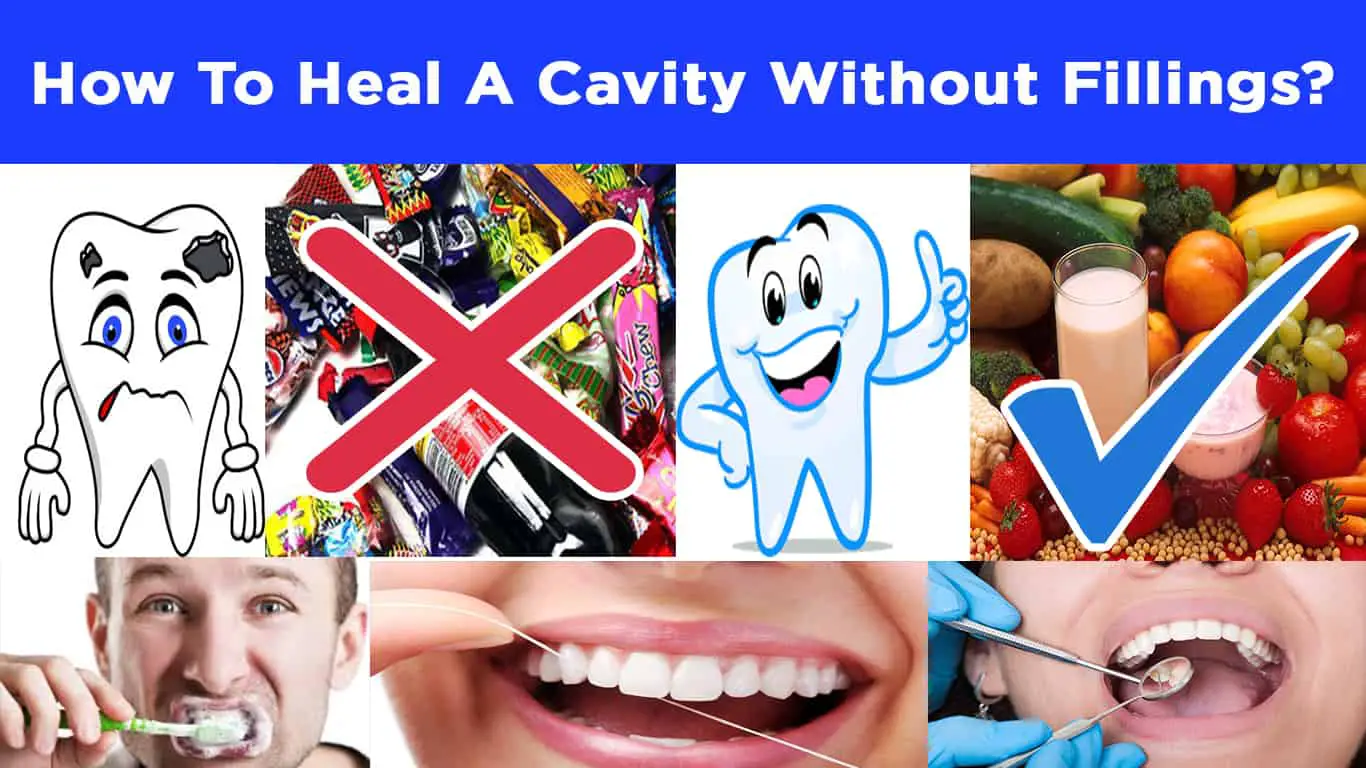 How to Heal A Cavity Without Fillings