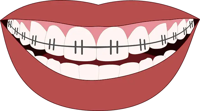 How Long Does it Take for Teeth to Shift