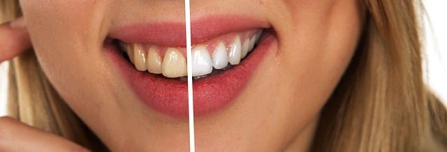How to Remove Coffee Stains from Teeth