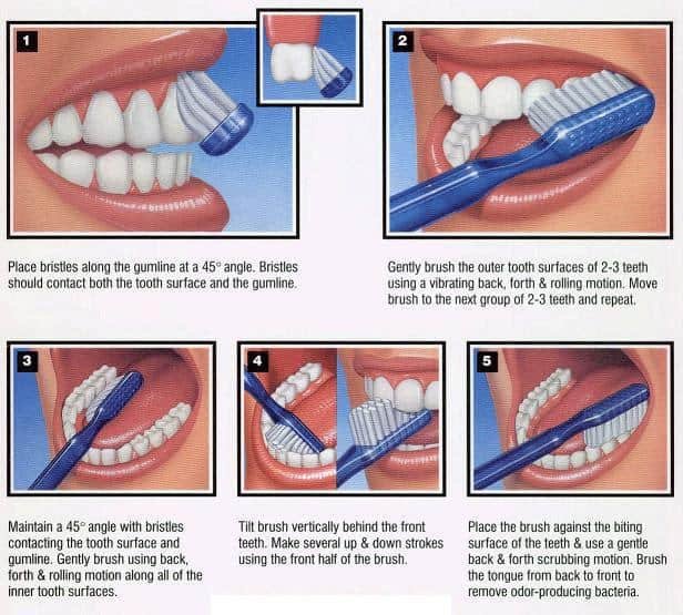 bass method toothbrushing