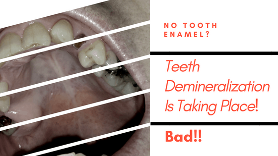 best way to remineralize teeth