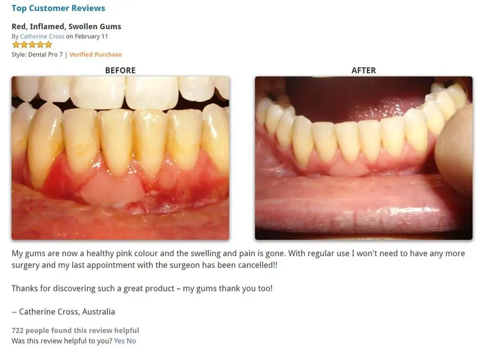 dental pro 7 customer review