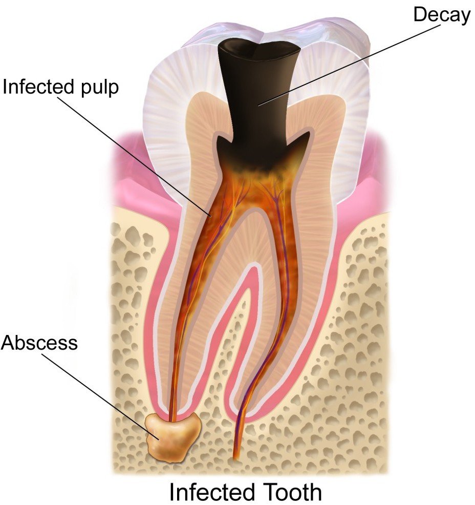 how to treat a toothache