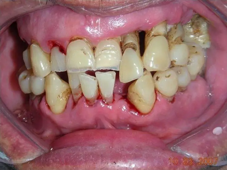 primal life organics teeth whitening reviews