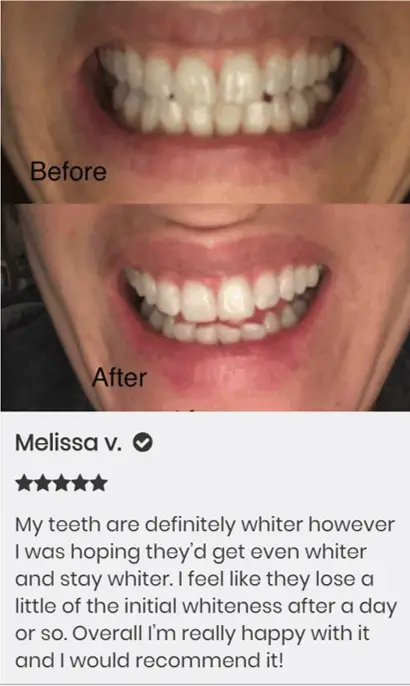snow teeth whitening review
