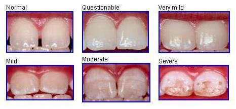 Remineralizing Tooth Powder